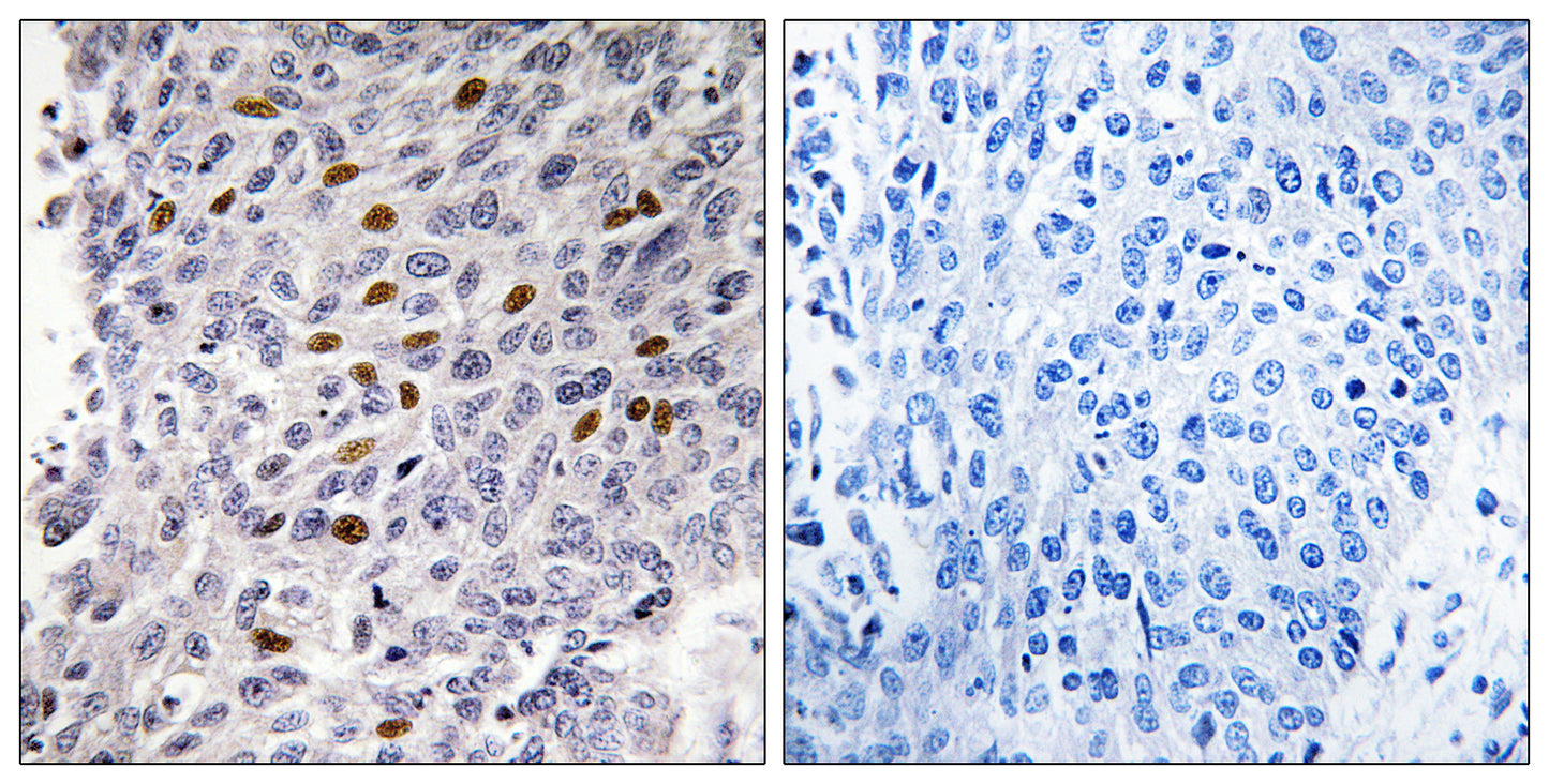 ATF-1 Rabbit Polyclonal Antibody