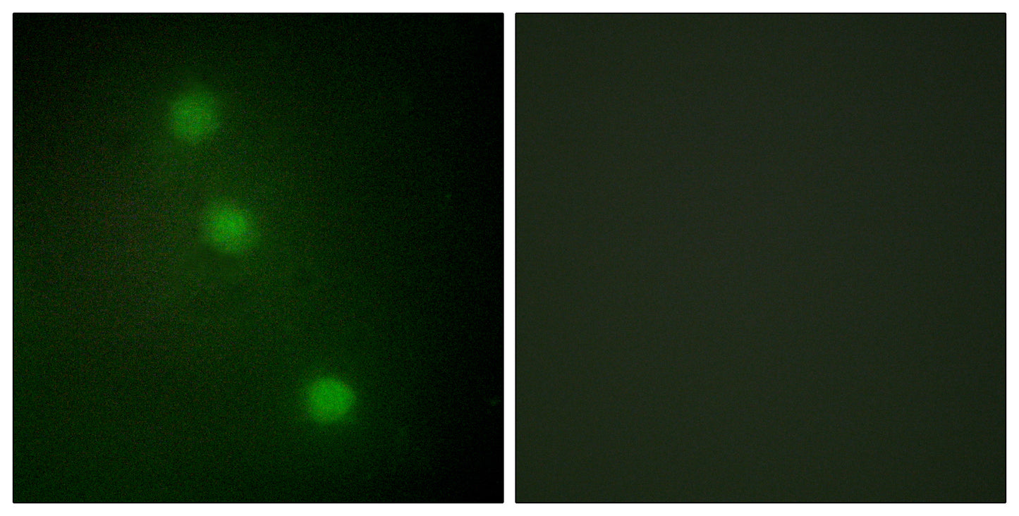 ATF-1 Rabbit Polyclonal Antibody