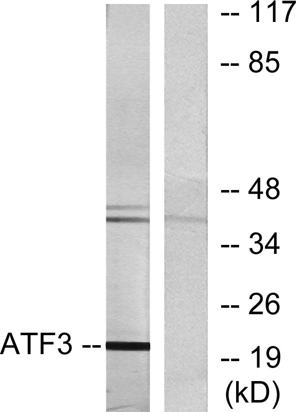 ATF-3 Rabbit Polyclonal Antibody