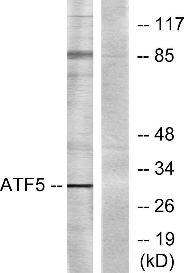 ATF-5 Rabbit Polyclonal Antibody