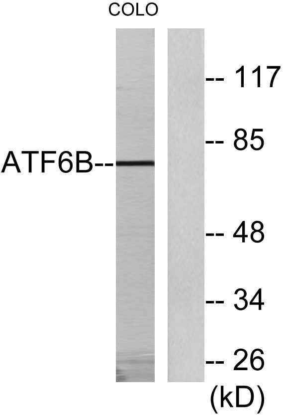 ATF-6β Rabbit Polyclonal Antibody