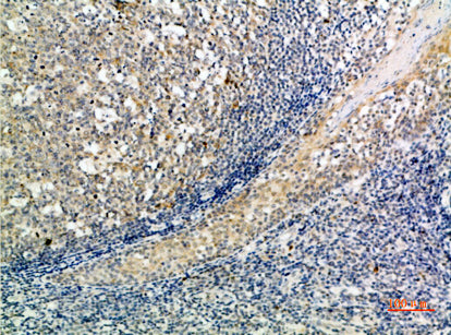 ATG10 Rabbit Polyclonal Antibody