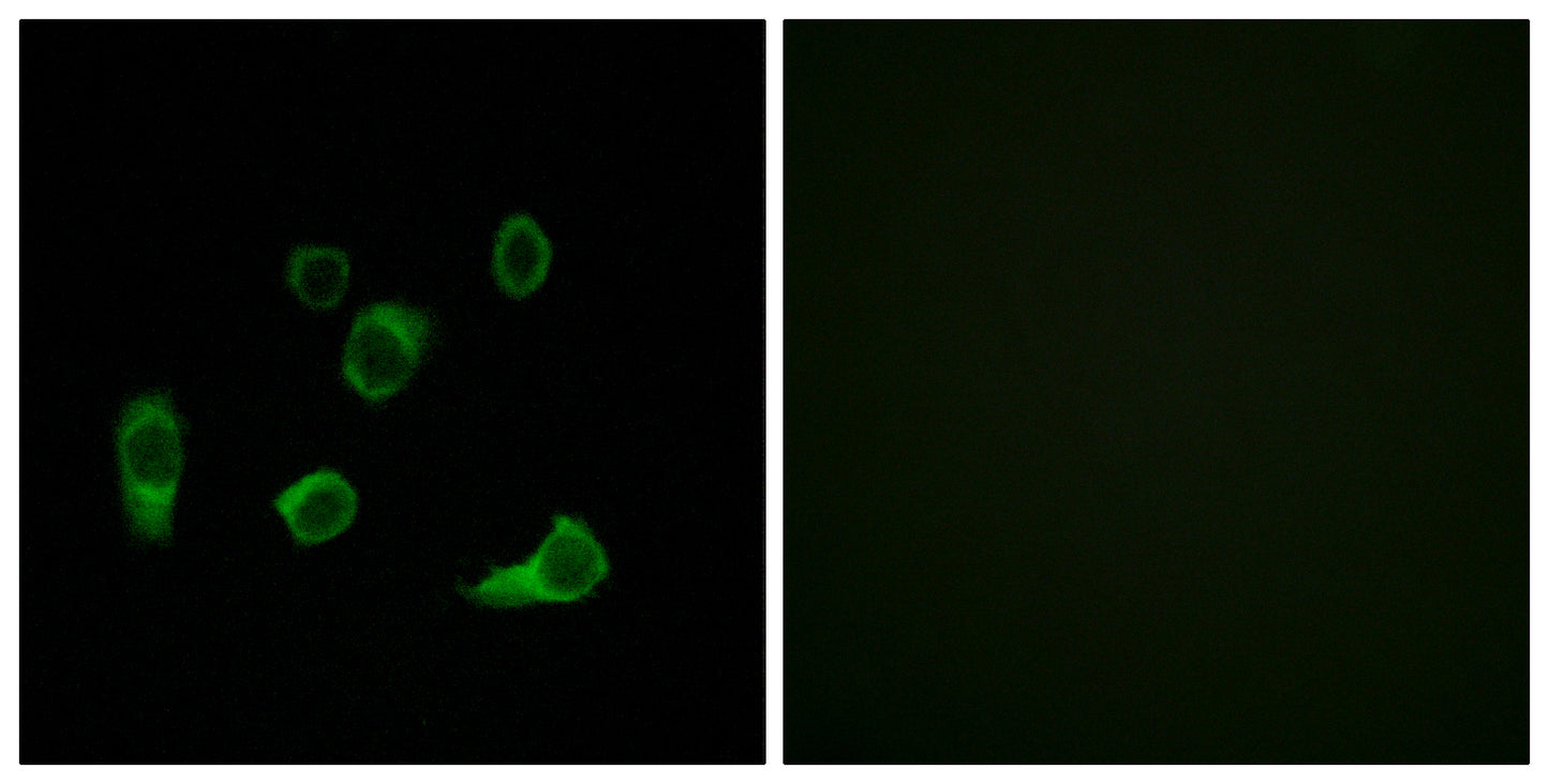 Atg4C Rabbit Polyclonal Antibody