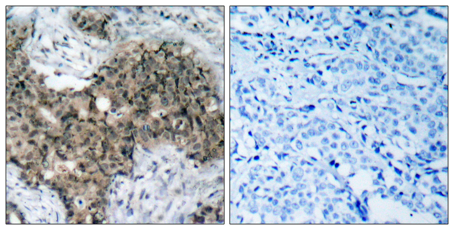 Atm Rabbit Polyclonal Antibody