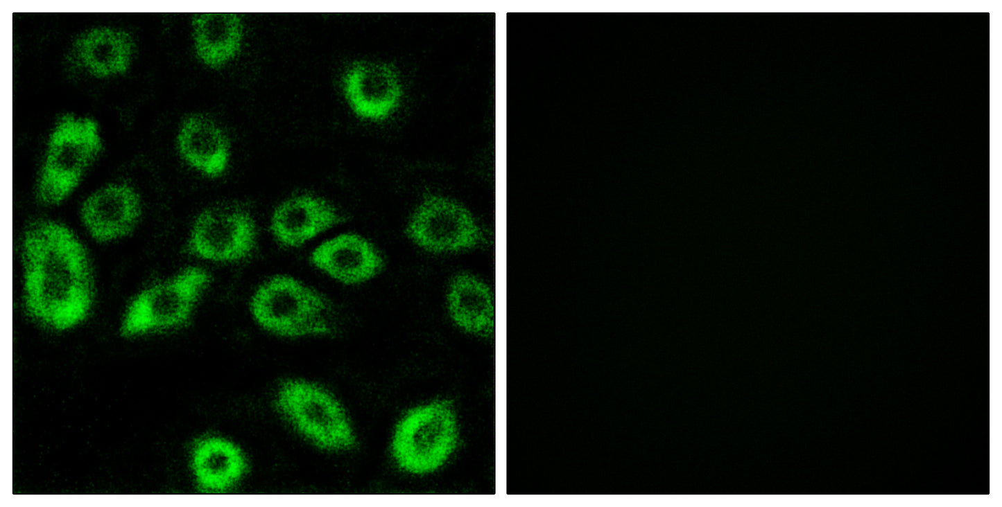 ATP5D Rabbit Polyclonal Antibody