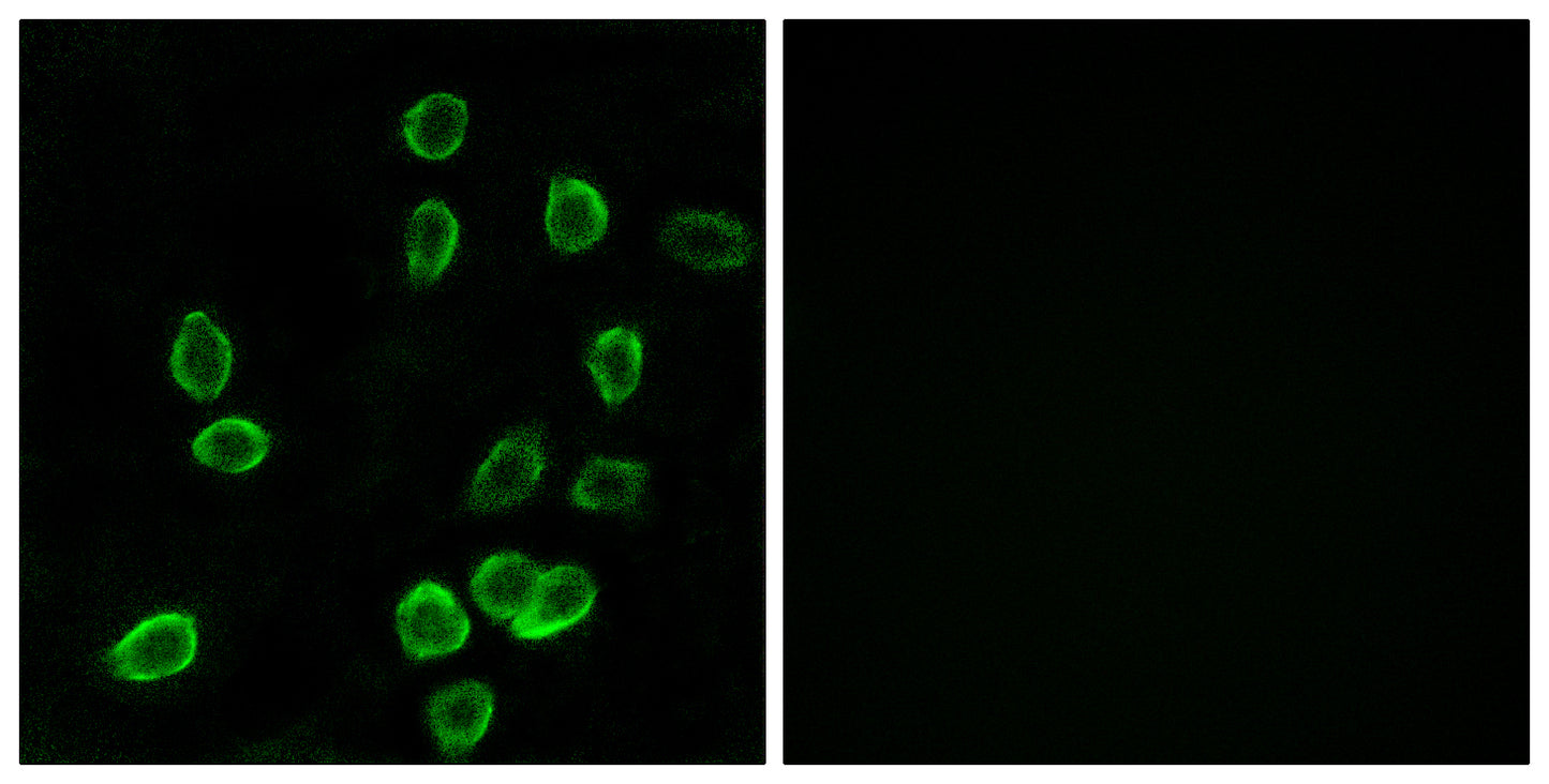 ATP5G3 Rabbit Polyclonal Antibody