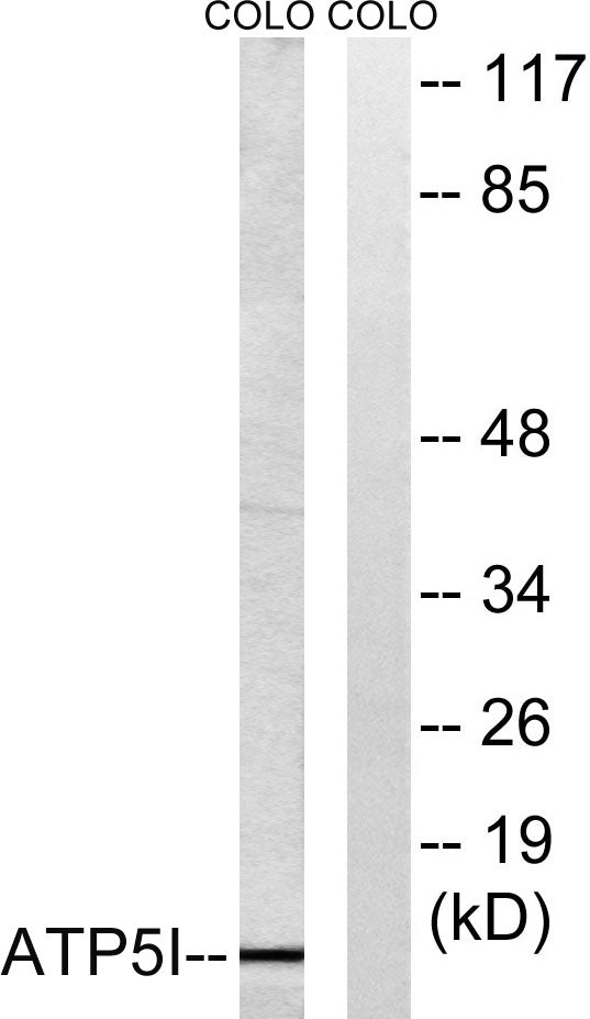 ATP5I Rabbit Polyclonal Antibody