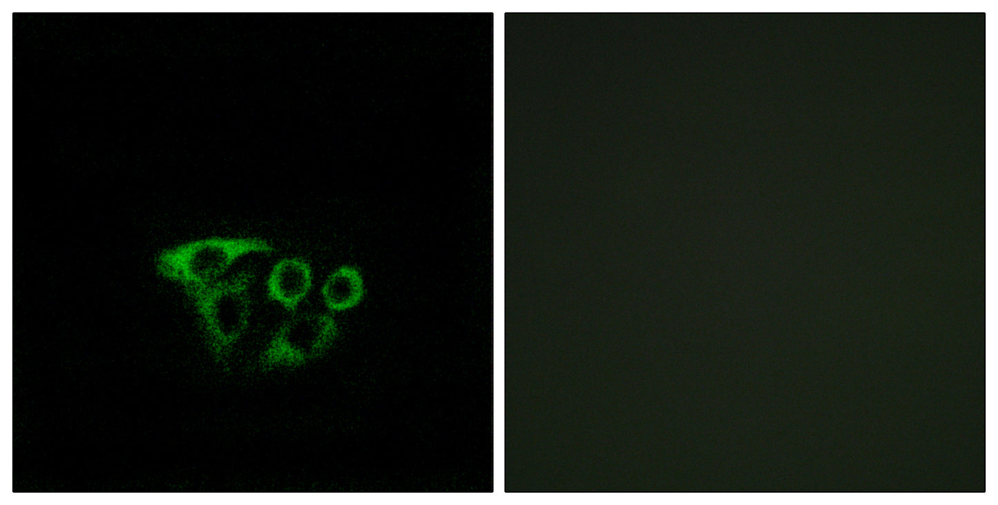 ATP5L2 Rabbit Polyclonal Antibody