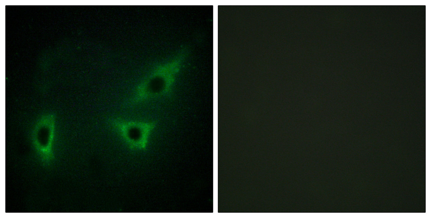 ATP7B Rabbit Polyclonal Antibody