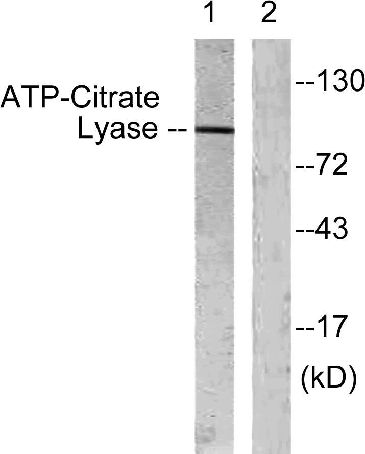 ATP-citrate synthase Rabbit Polyclonal Antibody