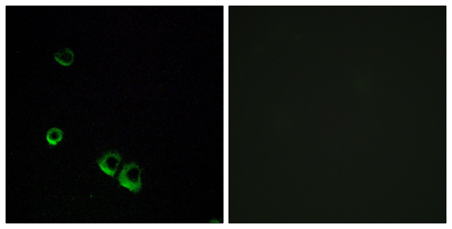 AVP Receptor V2 Rabbit Polyclonal Antibody