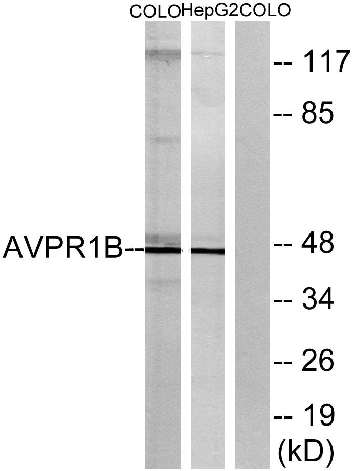 AVP Receptor V3 Rabbit Polyclonal Antibody