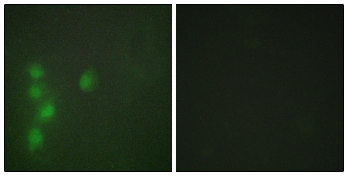 AW-1 Rabbit Polyclonal Antibody