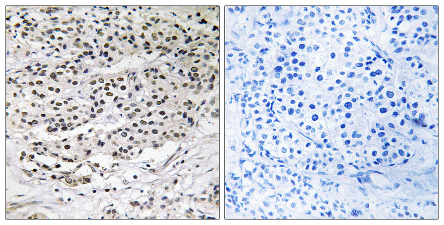 AZI1 Rabbit Polyclonal Antibody