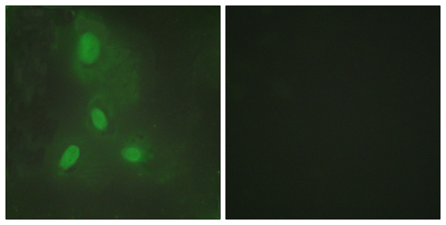BACH1 Rabbit Polyclonal Antibody