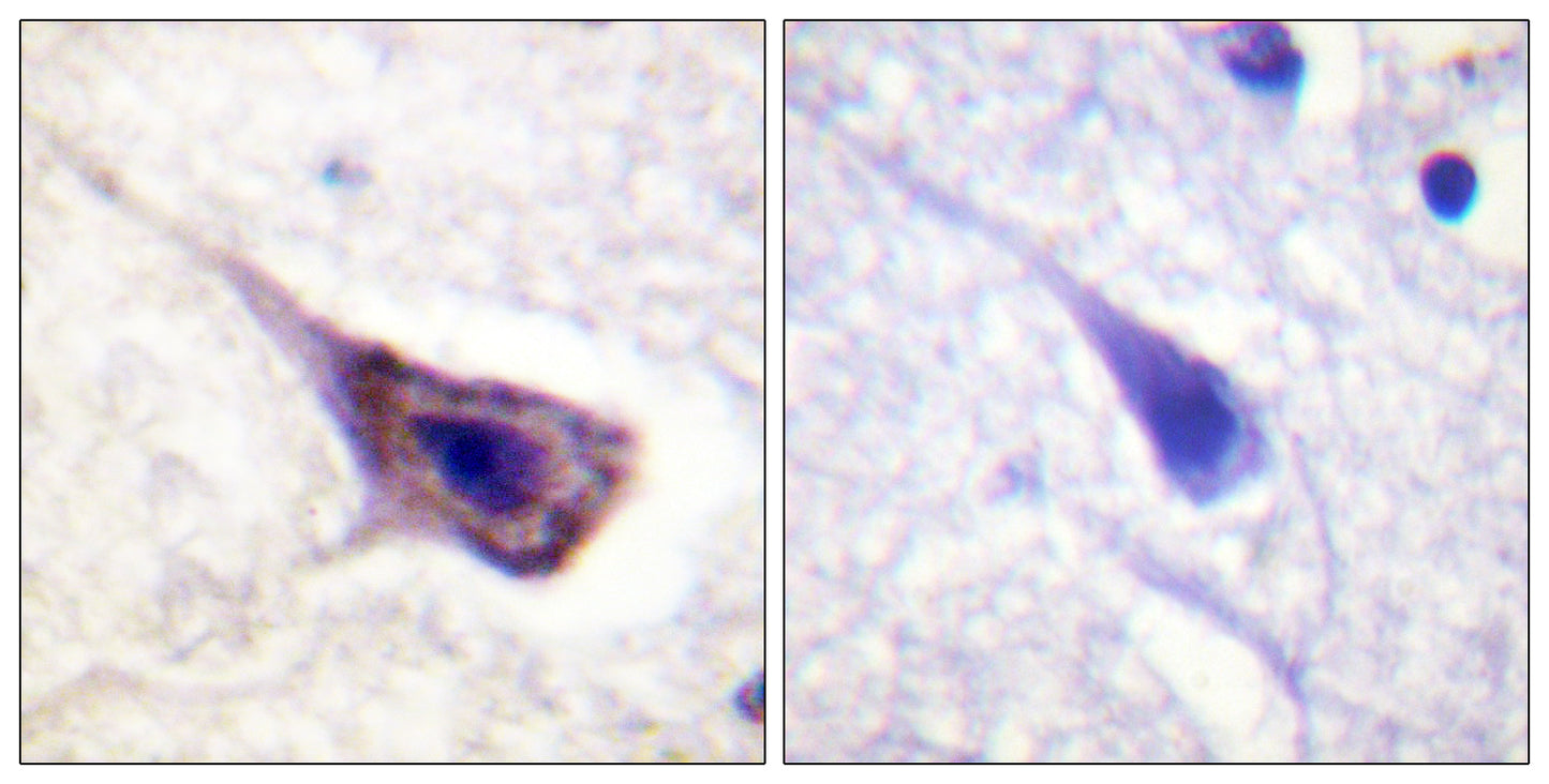 Bad Rabbit Polyclonal Antibody