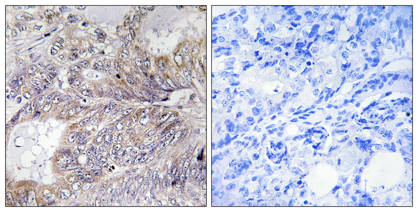 Bad Rabbit Polyclonal Antibody