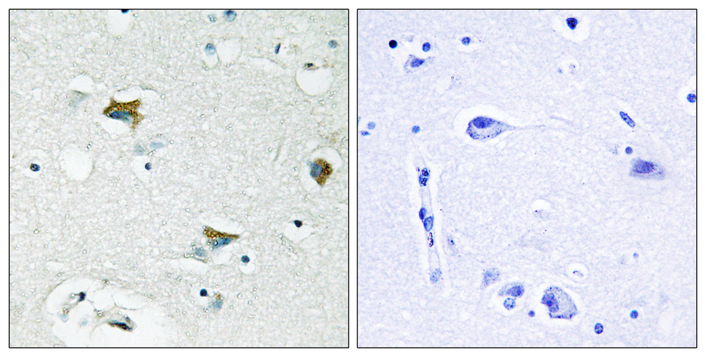 Bad Rabbit Polyclonal Antibody
