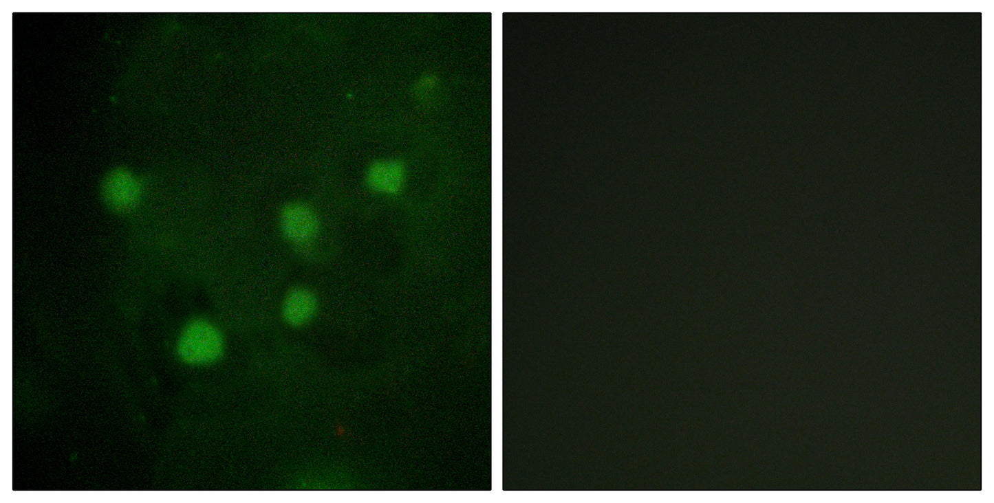 BAF250b Rabbit Polyclonal Antibody