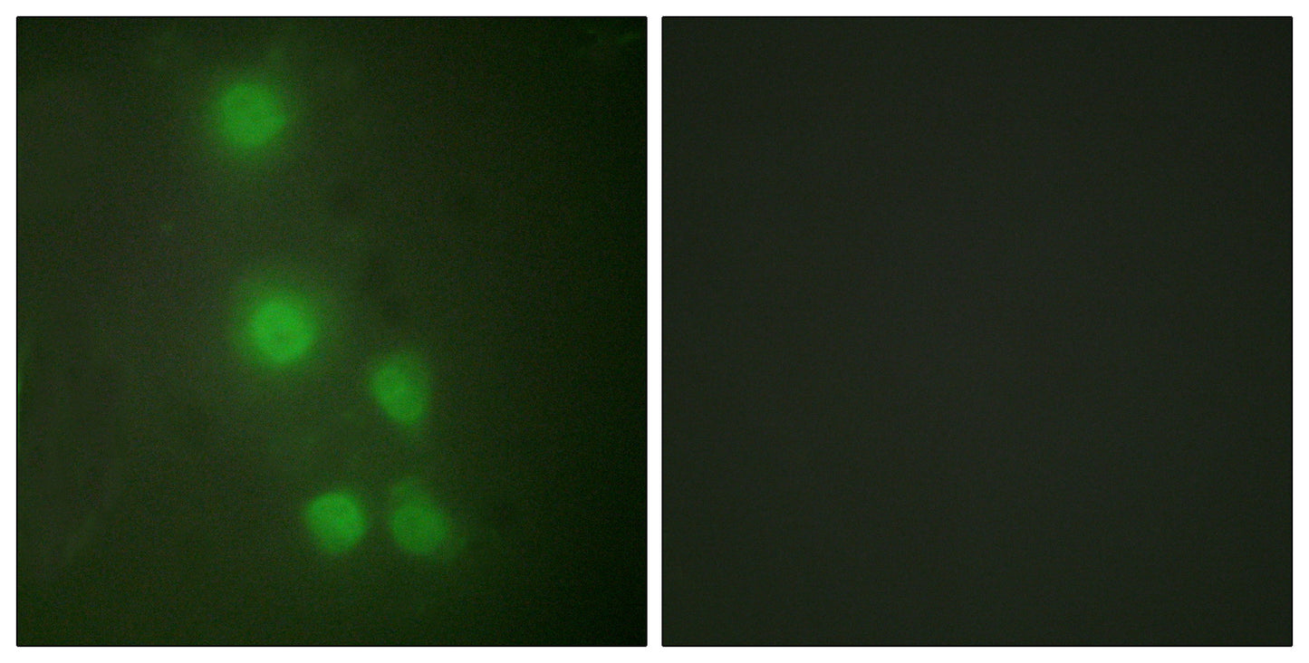 BAF53 Rabbit Polyclonal Antibody