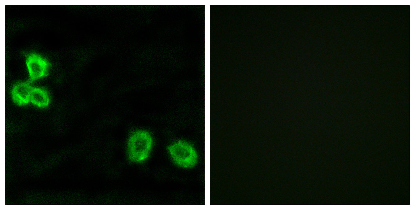 BAI-1 Rabbit Polyclonal Antibody