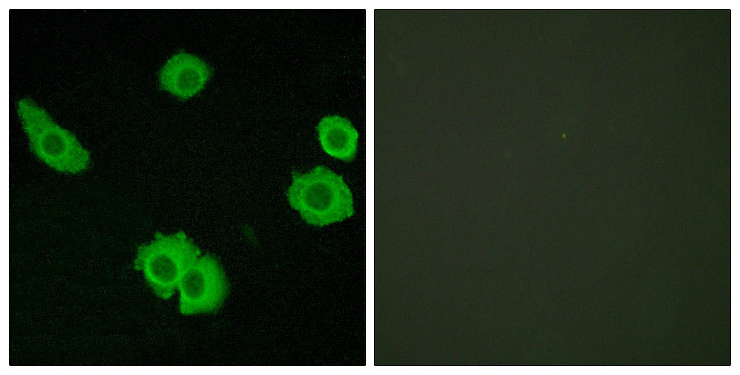 BAI-3 Rabbit Polyclonal Antibody