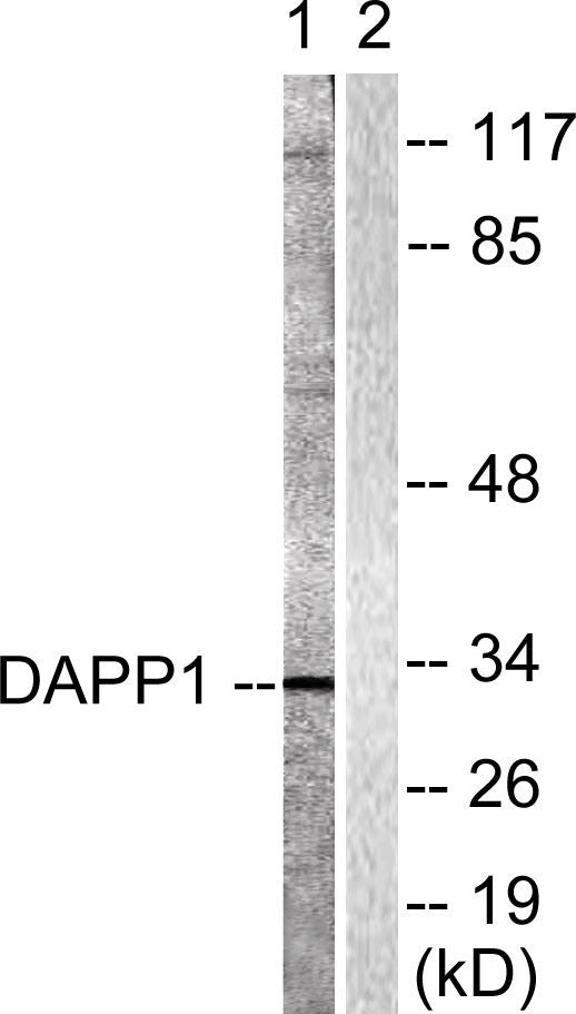 BAM32 Rabbit Polyclonal Antibody