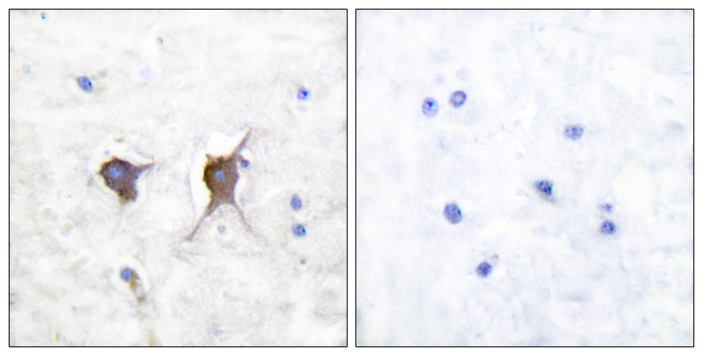 Bax Rabbit Polyclonal Antibody