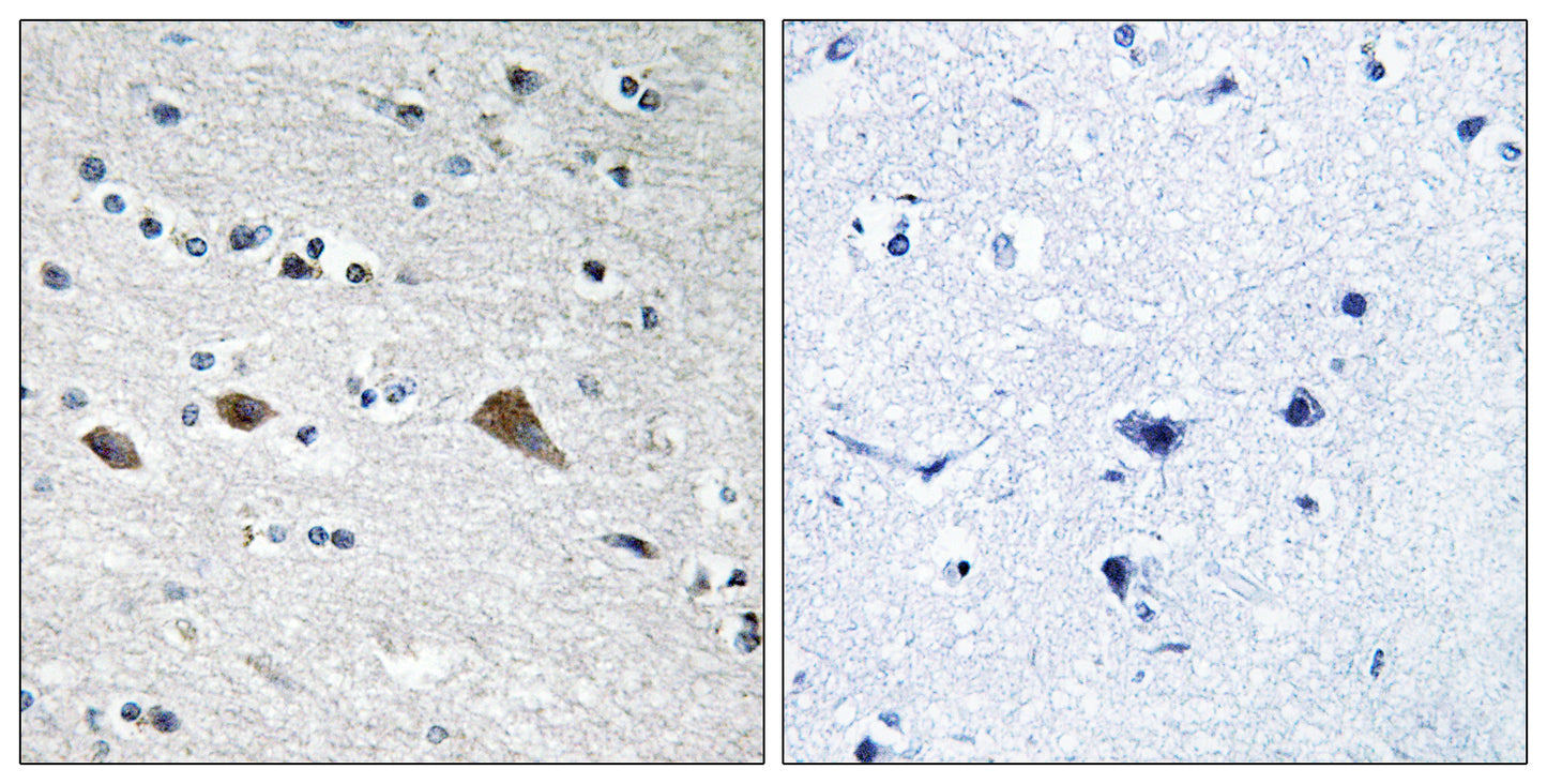 BCAR3 Rabbit Polyclonal Antibody