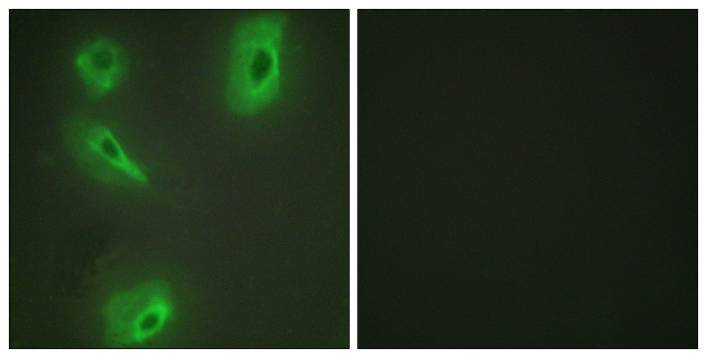 BCKDK Rabbit Polyclonal Antibody