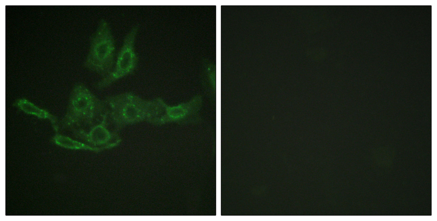 Bcl-2 Rabbit Polyclonal Antibody