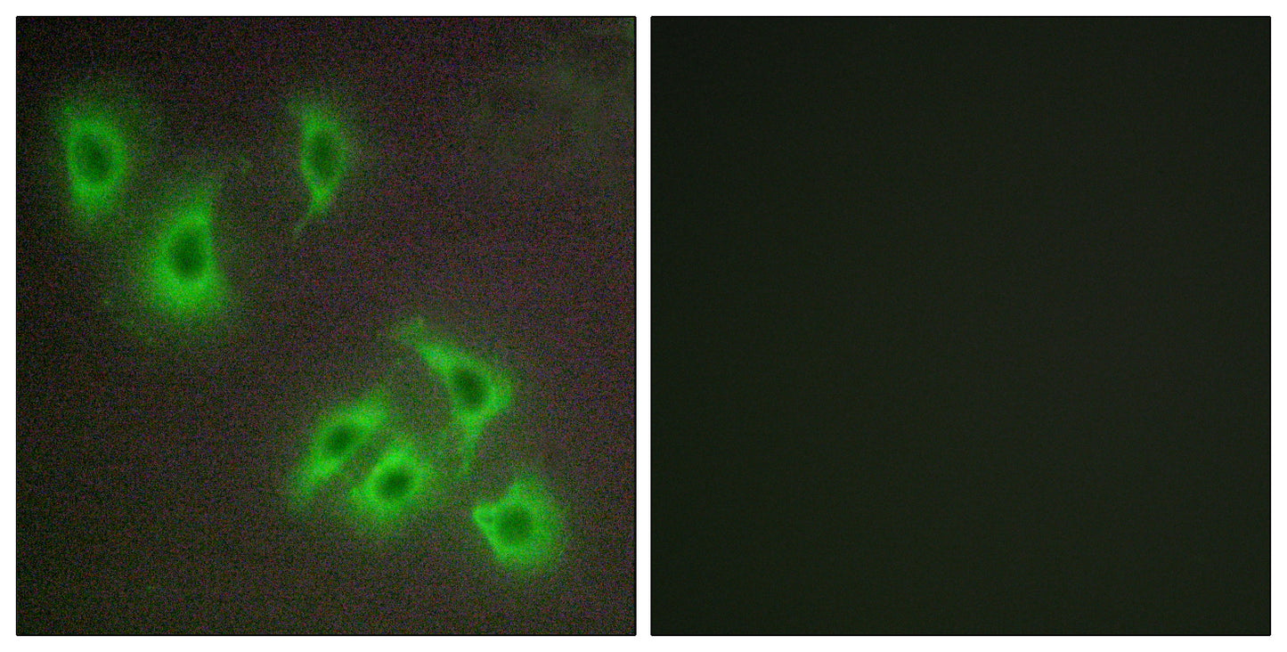 Bcl-w Rabbit Polyclonal Antibody
