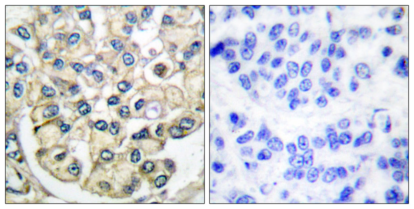Bek Rabbit Polyclonal Antibody