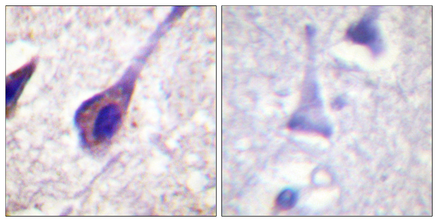BID Rabbit Polyclonal Antibody