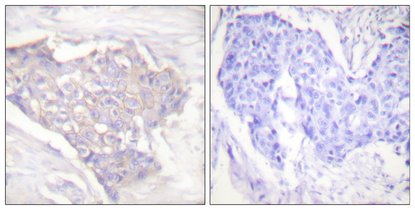Bim Rabbit Polyclonal Antibody
