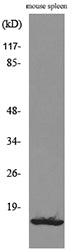 BLC Rabbit Polyclonal Antibody