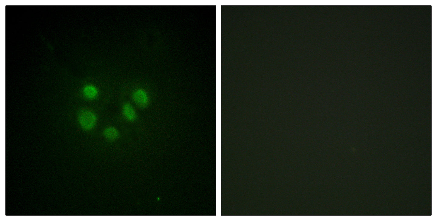 BLM Rabbit Polyclonal Antibody