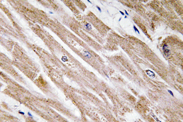 BMP-5 Rabbit Polyclonal Antibody