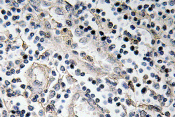 BMP-7 Rabbit Polyclonal Antibody