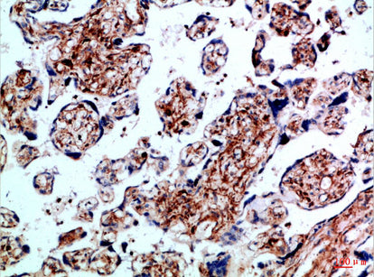 BMPR-IB Rabbit Polyclonal Antibody