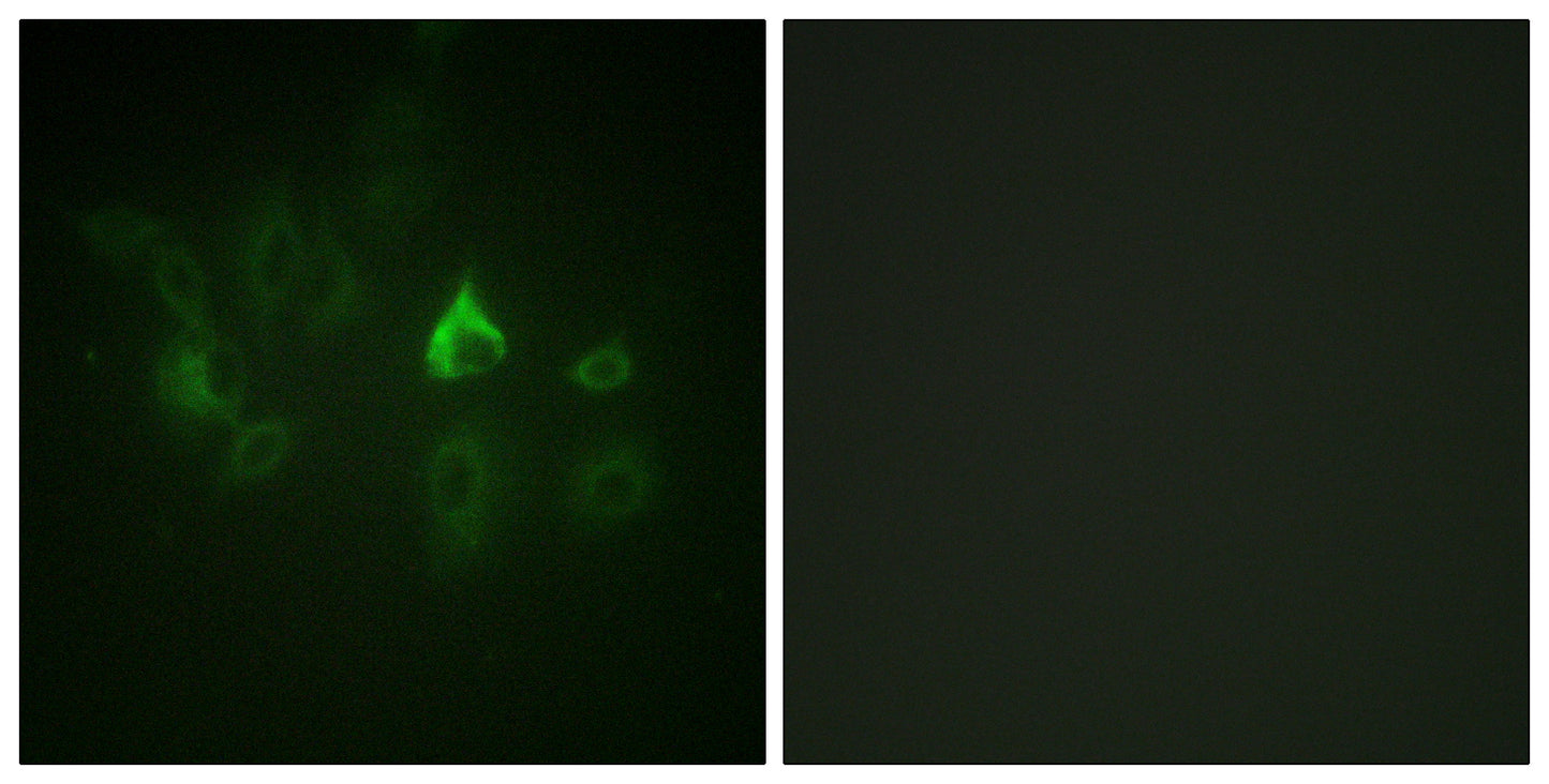 Bmx Rabbit Polyclonal Antibody