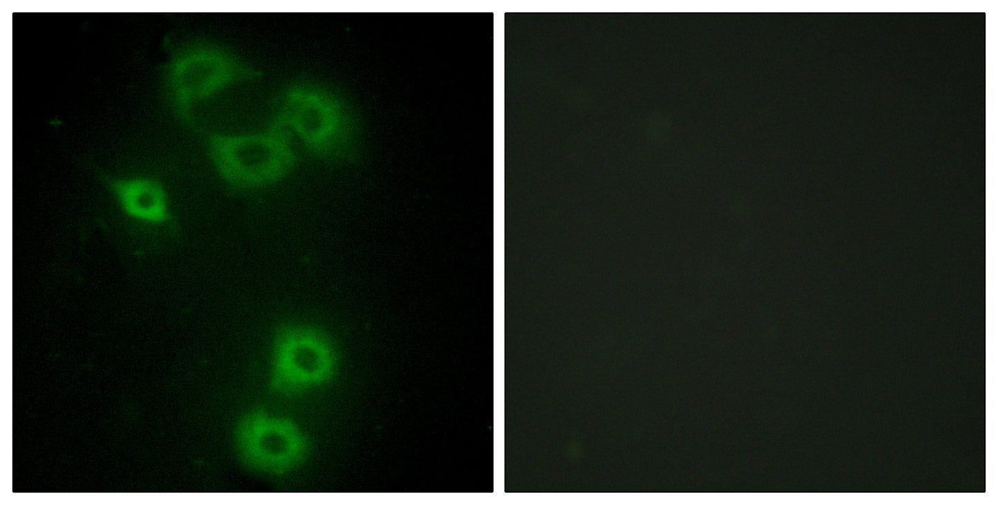 Bmx Rabbit Polyclonal Antibody