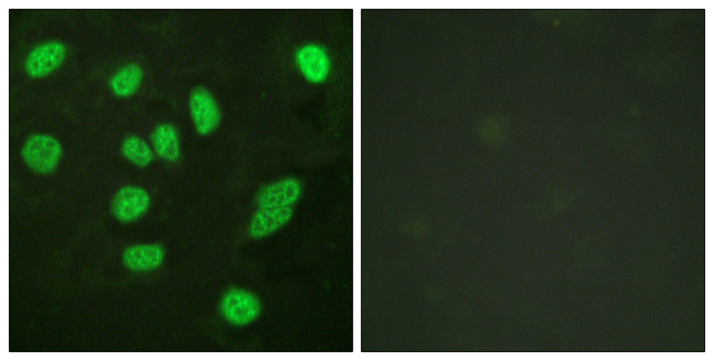 B-Myb Rabbit Polyclonal Antibody