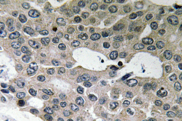BNIP-2 Rabbit Polyclonal Antibody