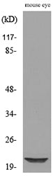 BNIP-3 Rabbit Polyclonal Antibody