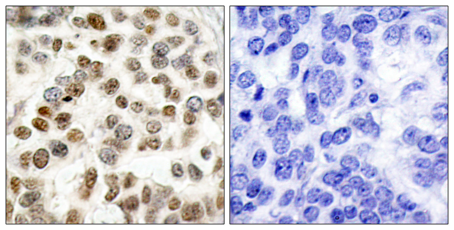 BRCA1 Rabbit Polyclonal Antibody