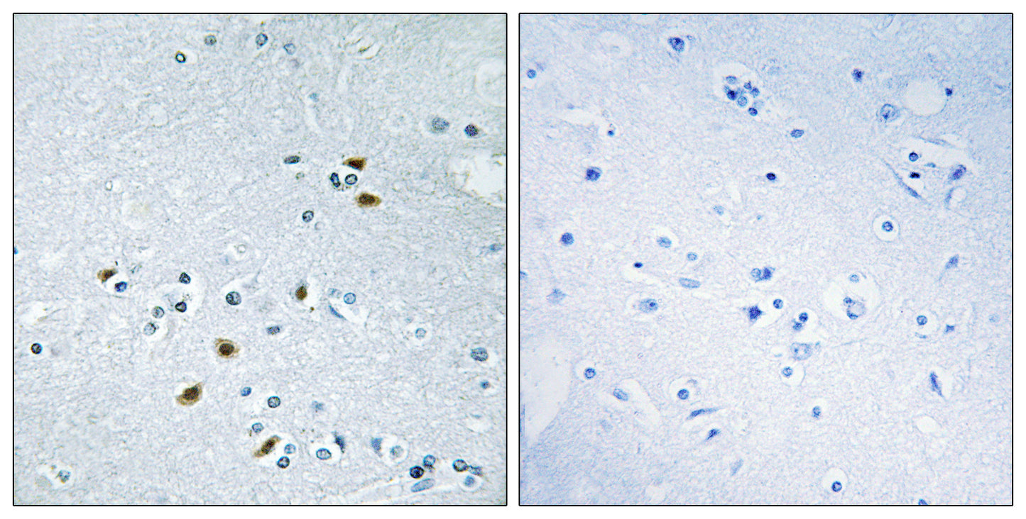 BRCA2 Rabbit Polyclonal Antibody