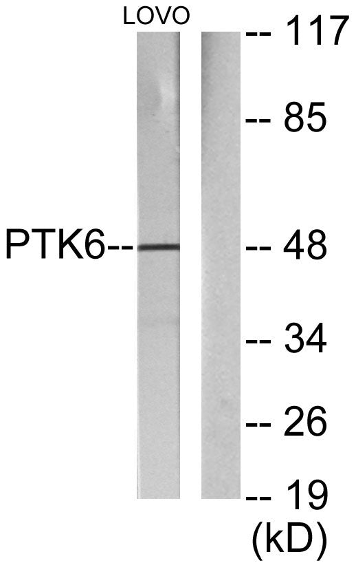 Brk Rabbit Polyclonal Antibody