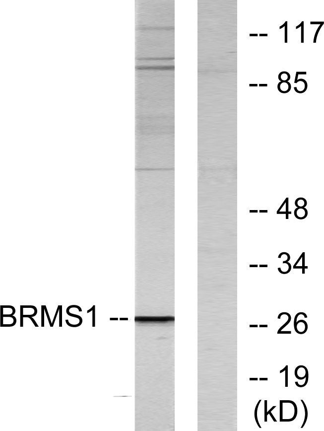 BRMS-1 Rabbit Polyclonal Antibody