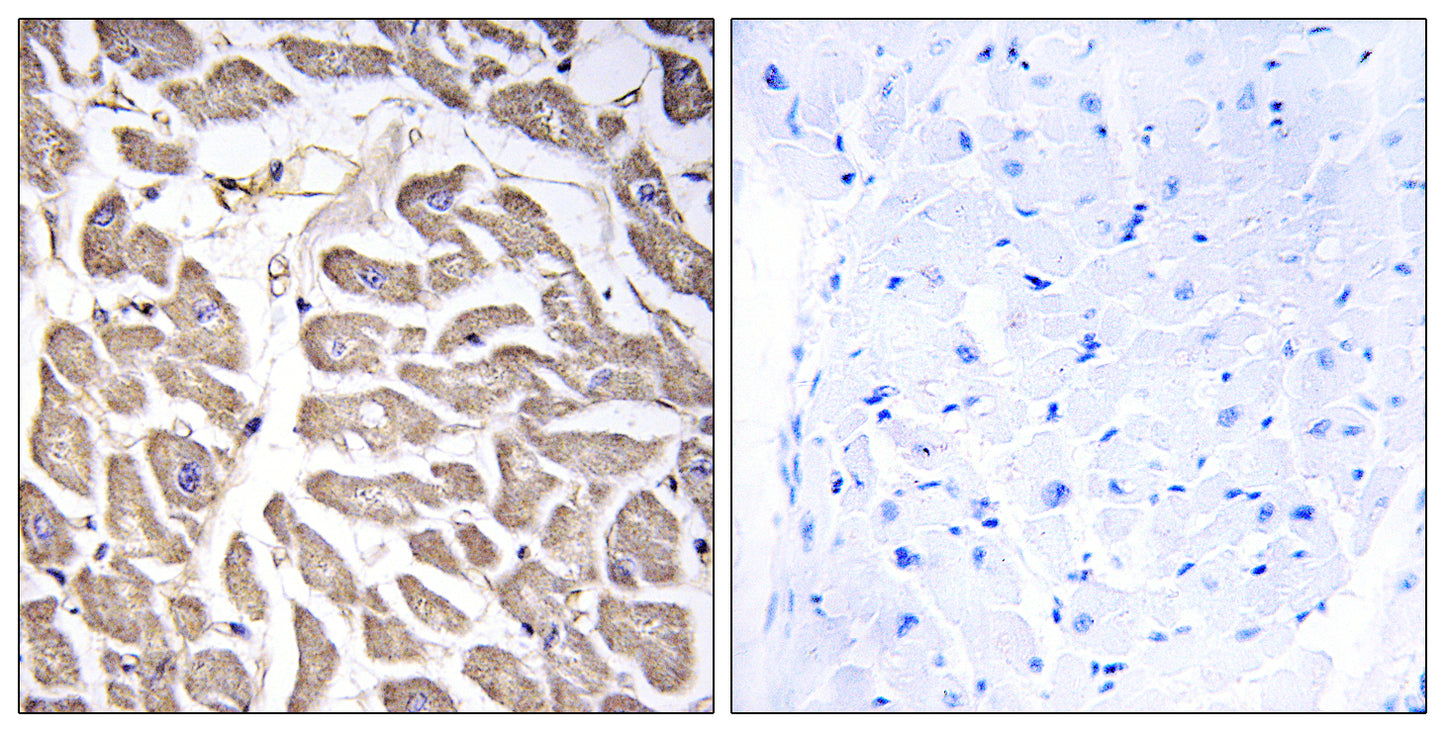 BRWD3 Rabbit Polyclonal Antibody